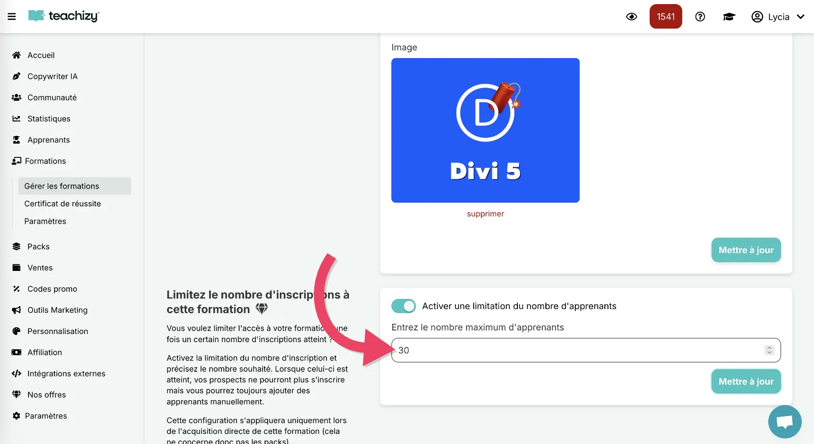 limitation limitation